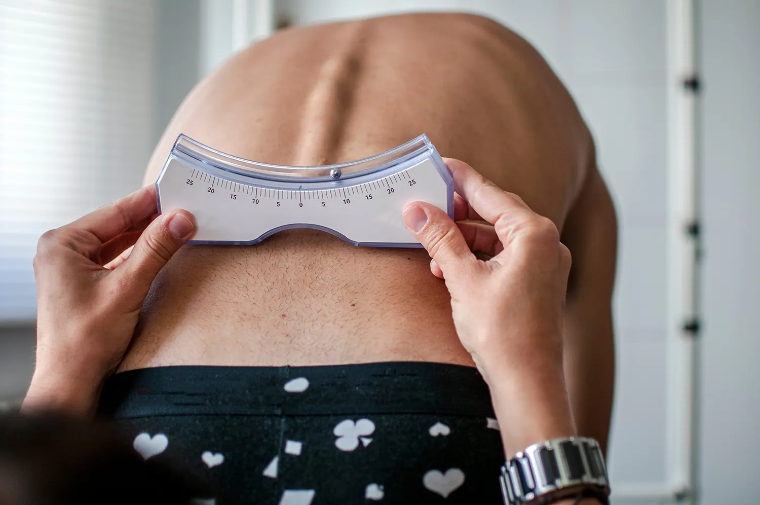 Scoliosis screening spine evaluation