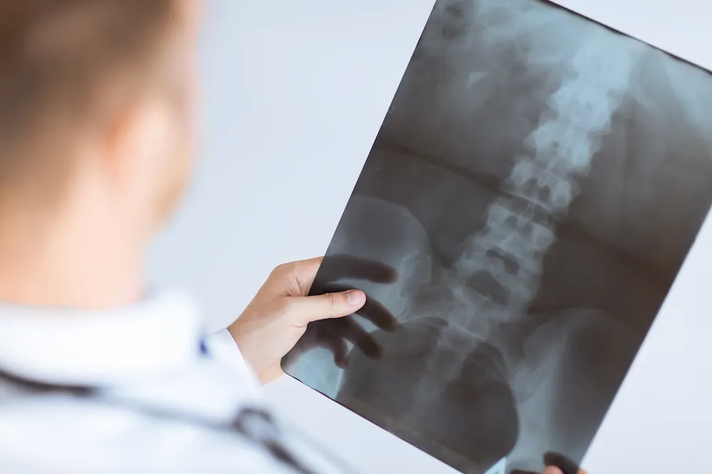 Spine X-ray imaging