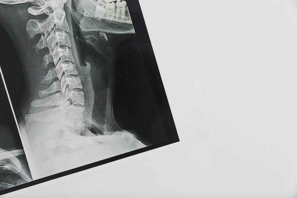 X-ray scan